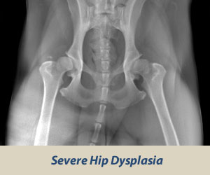 hips severe