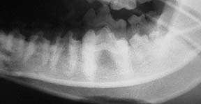 Tooth korene